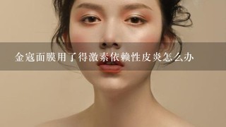 金寇面膜用了得激素依赖性皮炎怎么办