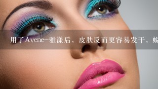 用了Avene-雅漾后，皮肤反而更容易发干，蜕皮， 怎