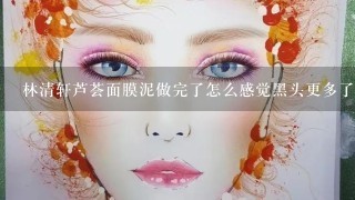 林清轩芦荟面膜泥做完了怎么感觉黑头更多了呢